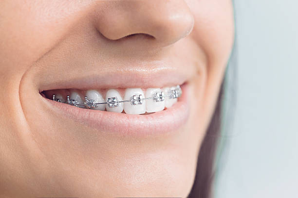 Best Invisalign and Clear Aligners  in Canton, IL